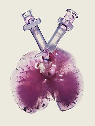 labgrownlungs patent1