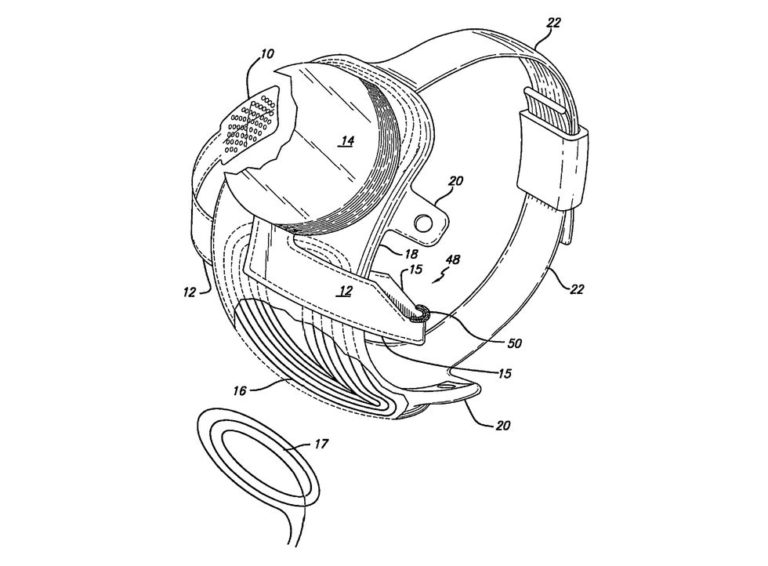 Bionic Eye